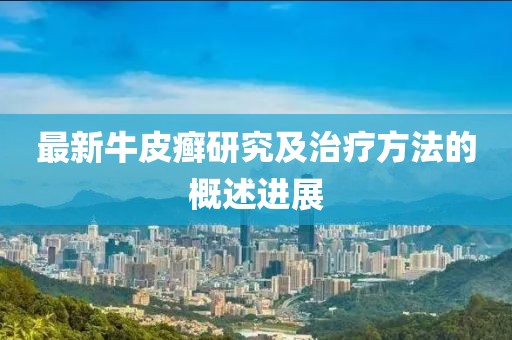 最新牛皮癣研究及治疗方法的概述进展